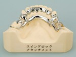 部分入れ歯・アタッチメント