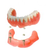 �C���v�����g�Ɠ��ꎕ�̍\��