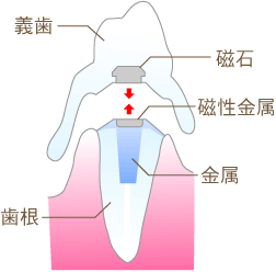 ꎕlIW[΂ŌŒE`斃z\